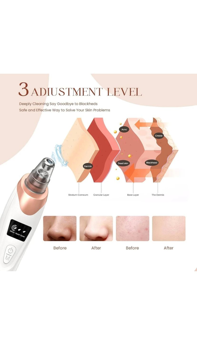Rechargeable Blackhead Remover Vacuum – Facial Pore Cleaner with 5 Suction Heads & LED Display
